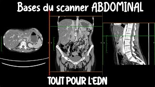 Les fondamentaux de limagerie abdominale  R2C  EDN  Médecine [upl. by Cleave738]