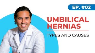 Umbilical Hernias Types and Causes Houston Texas [upl. by Aela967]