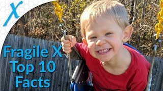 Fragile X Syndrome FXS 10 Things You Did Not Know [upl. by Tamara]