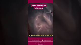 Como o bebê fica dentro da barriga da mamãe  gestacao parto mamae prenatal [upl. by Calvin]