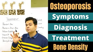 Osteoporosis Signs amp Symptoms How to Check Bone Density DEXA Scan Osteoporosis Treatment [upl. by Goodhen]