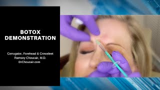 Botox® Demonstration Corrugators Forehead amp Crowsfeet  Ramsey Choucair MD  Ph 2143899797 [upl. by Magena]