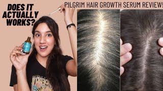 Pilgrim Redensyl amp Anagain Hair Serum For Hair Growth Review amp Results Does It Actually Works [upl. by Angel]