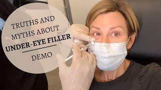 UNDER EYE FILLERS Before amp After  Restylane Results Truths amp MYTHS  Dominique Sachse [upl. by Nidroj]