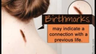 Are Birthmarks Related to Our Past Life Experiences [upl. by Lesly]