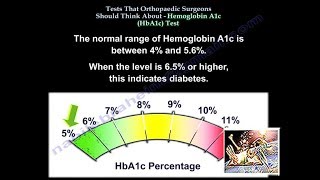 Hemoglobin A1c Tests Ortho Surgeons Think About  Everything You Need To Know  Dr Nabil Ebraheim [upl. by Etnohs]