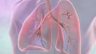 Treatments for lung cancer  Cancer Research UK [upl. by Louls]