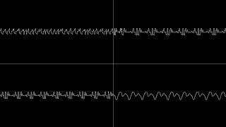 Plogue Chipsounds Test 4x D1771C [upl. by Quin]