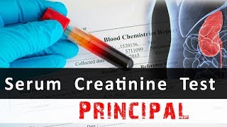 Serum Creatinine Test Principal [upl. by Kimmi]