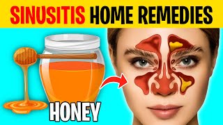 10 Home Remedies to Get Rid of Sinusitis [upl. by Nonahs]