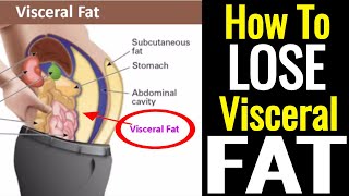 How To Lose Visceral Fat – Its Not As Hard As You Think [upl. by Ribak]