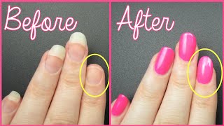 FIX A BROKEN NAIL FAST [upl. by Mcfarland909]