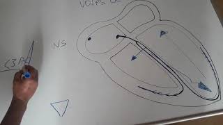 ECG Interpretation très facile de LECG5ème partie [upl. by Isabelita]