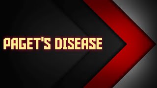 PAGETS DISEASE  FIBROOSSEOUS LESIONS [upl. by Joscelin]