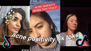 ACNE POSITIVITY TIKTOK COMPILATION  BODY POSITIVITY TIKTOK COMPILATION [upl. by Materse]