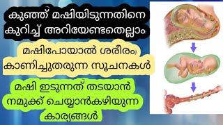 കുഞ്ഞ് വയറിനുള്ളിൽ മഷിയിടുന്നതിനെക്കുറിച് അറിയേണ്ടതെല്ലാംMECONIUM ASPIRATION SYNDROME Malayalam [upl. by Radbourne210]