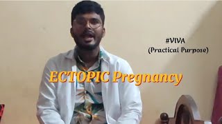 Obsampgyn viva Ectopicpregnancy Part 1 Introduction Site amp pathogenesis [upl. by Haya]