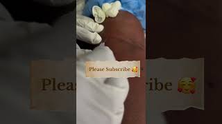 Blood sample collection technique 🩸💉nursing doctor hospital trending viralvideo ytshorts [upl. by Etnauj]