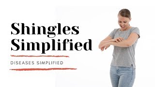 Shingles Simplified [upl. by Eirahs8]