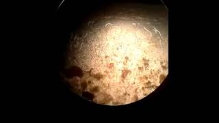 Aelurostrongylus abstrussus in cats Cat lungworm [upl. by Graner]