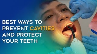 quotYour Teeth’s Worst Enemy How to Beat Cavities for Goodquot dentist caries teeth [upl. by Eelah]