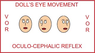 DOLLS EYE MOVEMENT OCULOCEPHALIC REFLEXVESTIBULOOCULAR REFLEX [upl. by Michi]