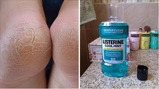 10 Amazing Uses For Listerine That Every Woman Should Know [upl. by Barbey38]