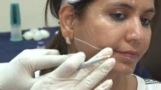 Complete video training on Botulinum Injections for face and Neck [upl. by Devehcoy]