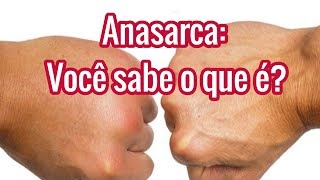 Anasarca Significado  O que é  Causas e Tratamentos [upl. by Dier]