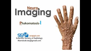 9 Neuro imaging Phacomatosis I  Prof Mamdouh Mahfouz [upl. by Lleneg51]