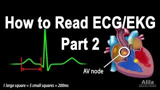 How to Read ECGEKG Part 2 Animation [upl. by Ayek]