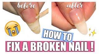 HOW TO EASILY FIX A BROKEN NAIL AT HOME  TEA BAG METHOD [upl. by Broderic109]