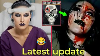 Latest update on Rhea Ripleys WWE return following head injury [upl. by Sirotek]