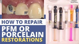 Composite  Your Complete Restorative Solution [upl. by Alderman]