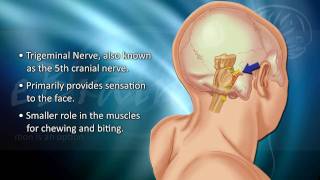 Understanding Trigeminal Neuralgia  eBrainMDcom [upl. by Bonnes]