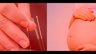 Pregnancy amp Acupuncture [upl. by Eaj]