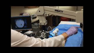 How to Focus and Use a Colposcope [upl. by Amada]