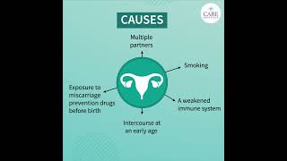 Things You Need to Know About Cervical Cancer  CARE Hospitals [upl. by Kam]