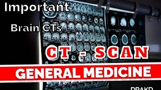 CT  SCAN GENERAL MEDICINEDRAKD [upl. by Aicile782]