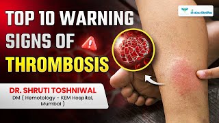 10 Warning Signs of Blood Clots You Must Know Types and Symptoms Explained by Dr Shruti Toshniwal [upl. by Arama328]