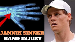 Jannik Sinner  Injured Hand at US Open [upl. by Uolyram]