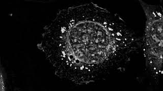 Labelfree live cell imaging of primary human keratinocytes for 3h30mins [upl. by Clausen]