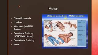 MedSurg GCS and NIH Stroke Scale [upl. by Care797]