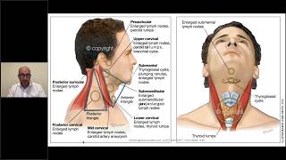 Fibroadenoma Symptoms Treatment and Causes [upl. by Iphlgenia]