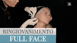 FULL FACE Ringiovanimento Viso con FILLER e BOTULINO  Drssa Beatrice Giorgini [upl. by Ehr543]