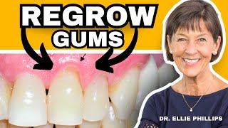 How To REGROW Receding Gums FIX Gum Recession At Home [upl. by Lemart]