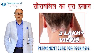 सोरायसिस का पूरा इलाज  Permanent Cure for Psoriasis  Dr Rohit Batra  In Hindi [upl. by Ratha678]