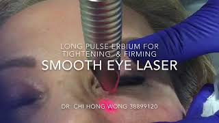 Fotona Smooth Eye Laser Brisbane  Laser to Tighten and Smooth Skin Around the Eyes [upl. by Ieso]