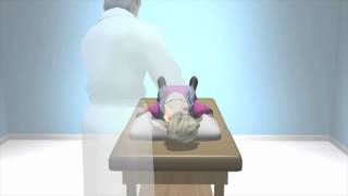 Dix Hallpike to Diagnose BPPV Dizziness [upl. by Boylston112]