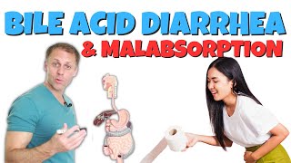 Understanding Bile Acid Diarrhea and Bile Acid Malabsorption [upl. by Acirem]